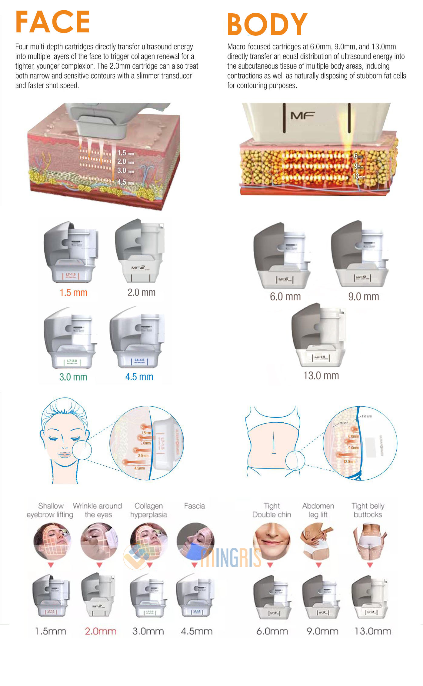 FU4.5 9SE 7D Hifu beauty machine 7 Cartridges Anti Wrinkle Face Lift Skin Tightening Body Slimming 7D Hifu Machine 11