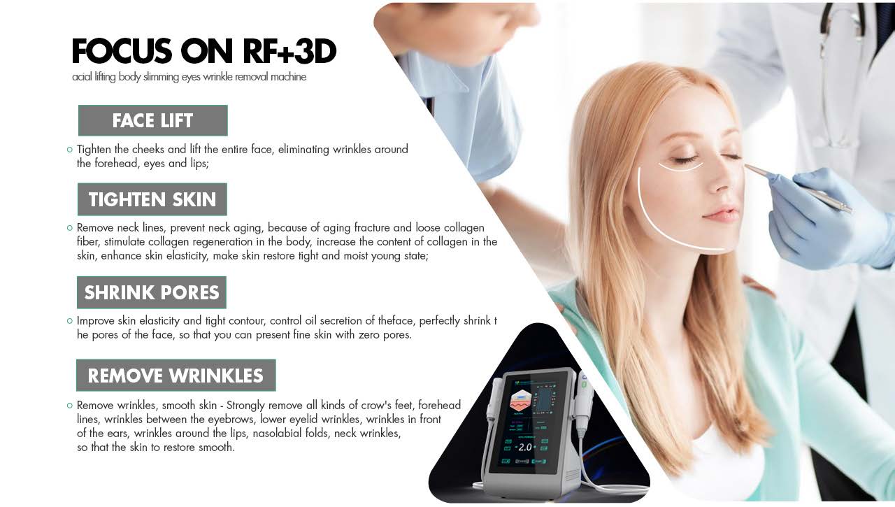 FU4.5 9SC ultramatrix 10