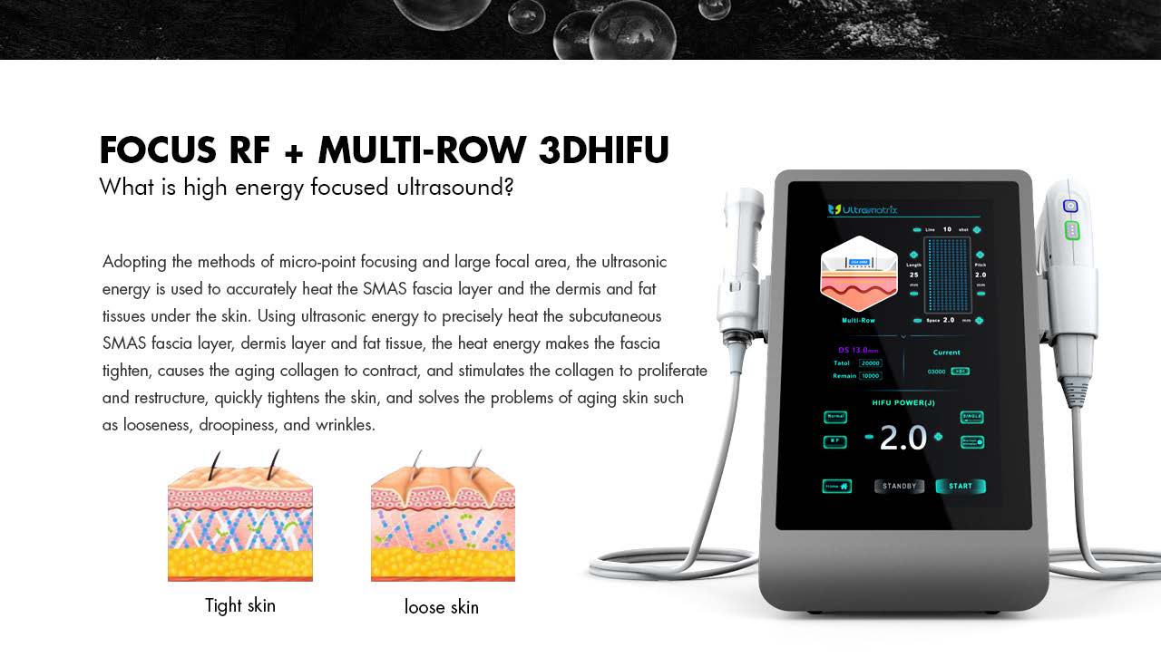 FU4.5 9SC ultramatrix rf 10