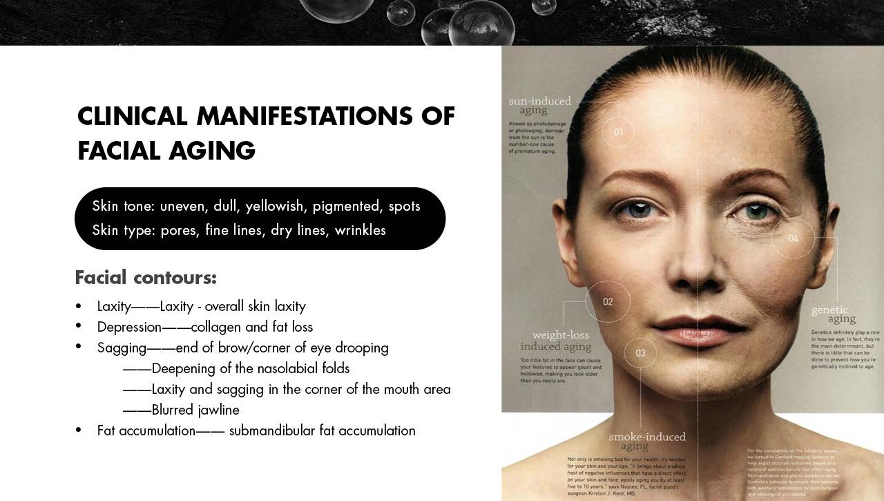 FU4.5 9SC ultramatrix rf 7