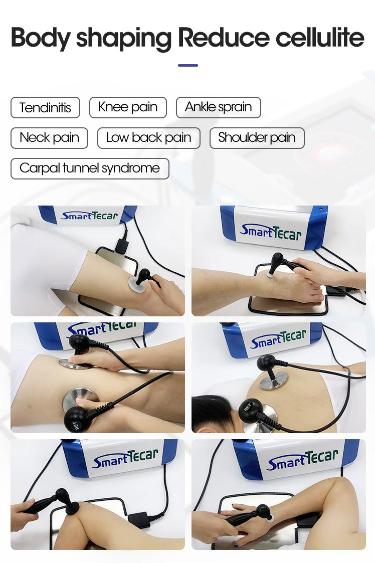 Smart Tecar 14 rf01 smart tecar monopolar rf fat reduction cellulite machine e1694677640633
