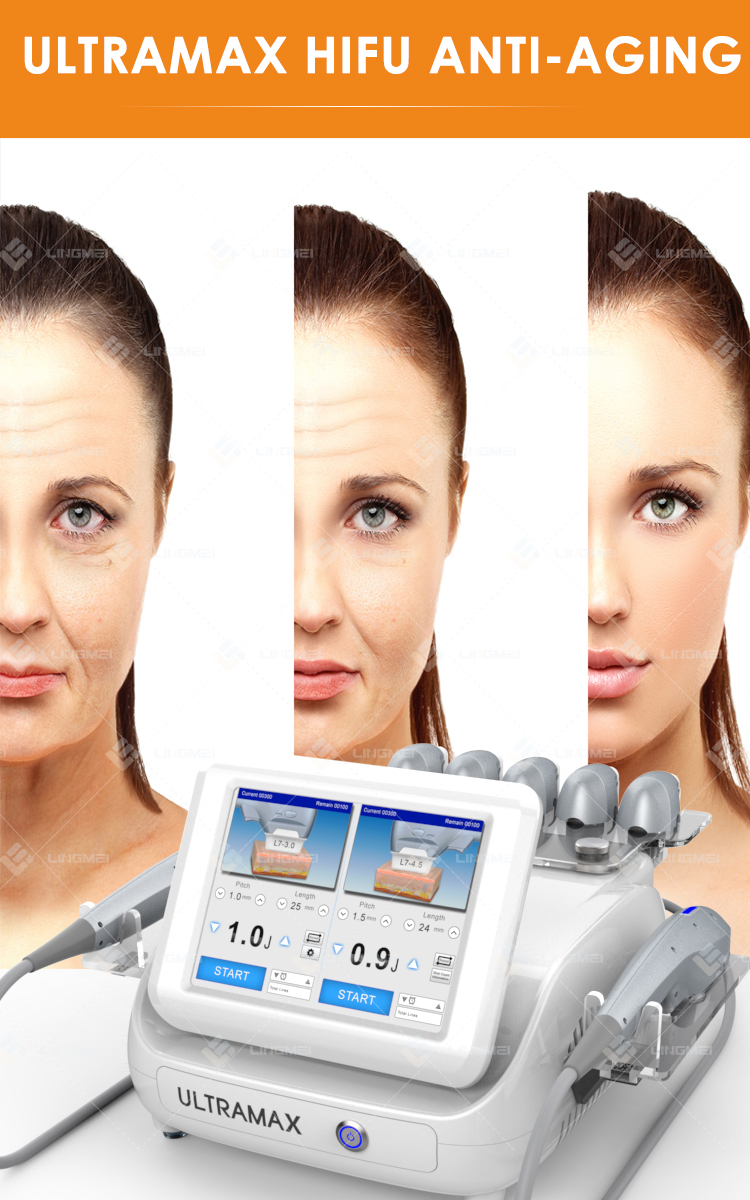 FU4.5 9SH ultramax hifu 10