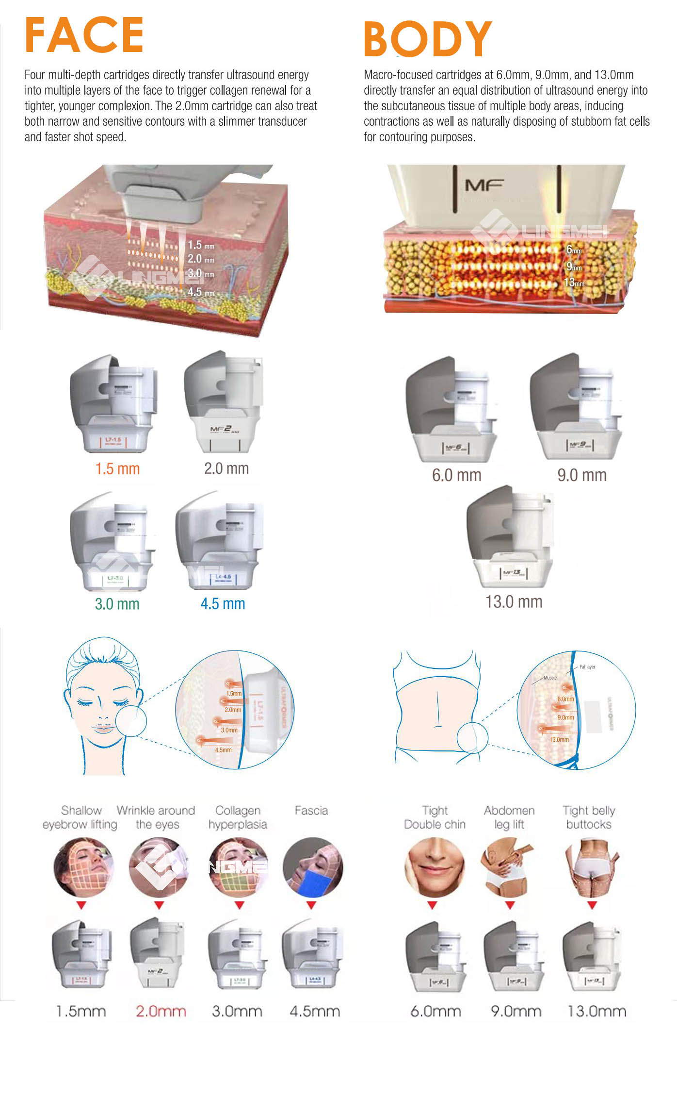 FU4.5 9SH ultramax hifu 7
