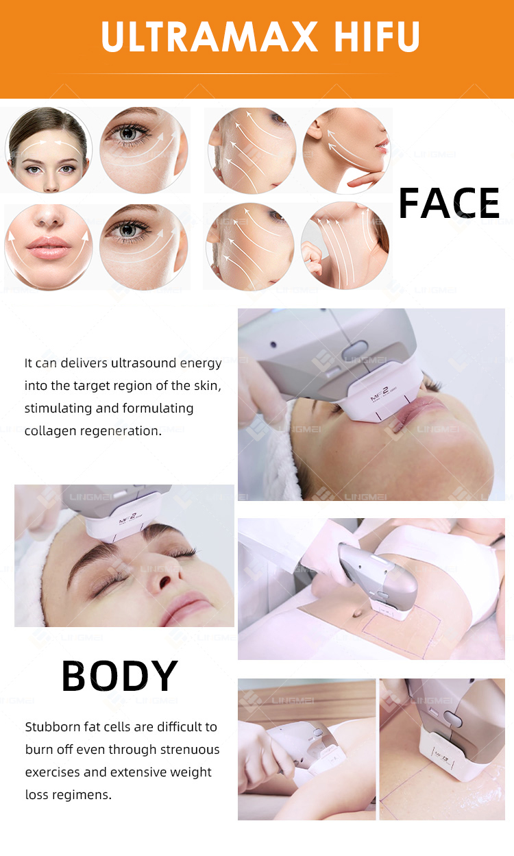 FU4.5 9SH ultramax hifu 9