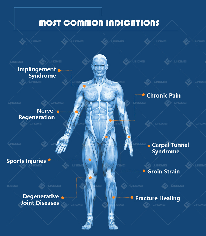 M6F PMST NEO PMFT 12