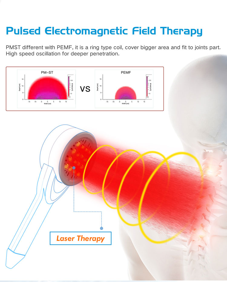 M6G pmst neo laser 11