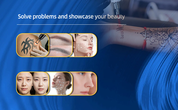 TSL 1121G9 picosecond laser 5