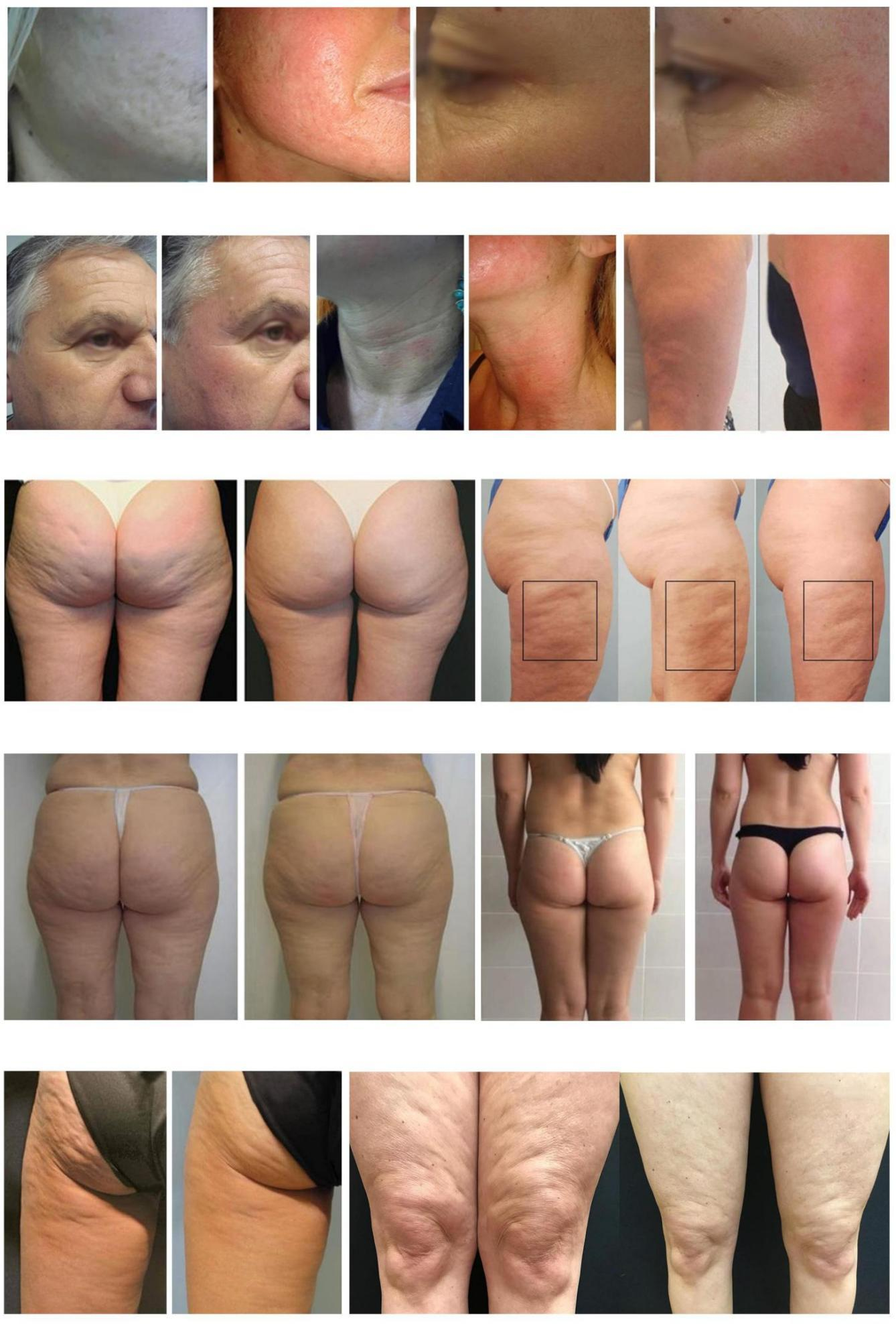 TSL 1113AF slimsphere 7