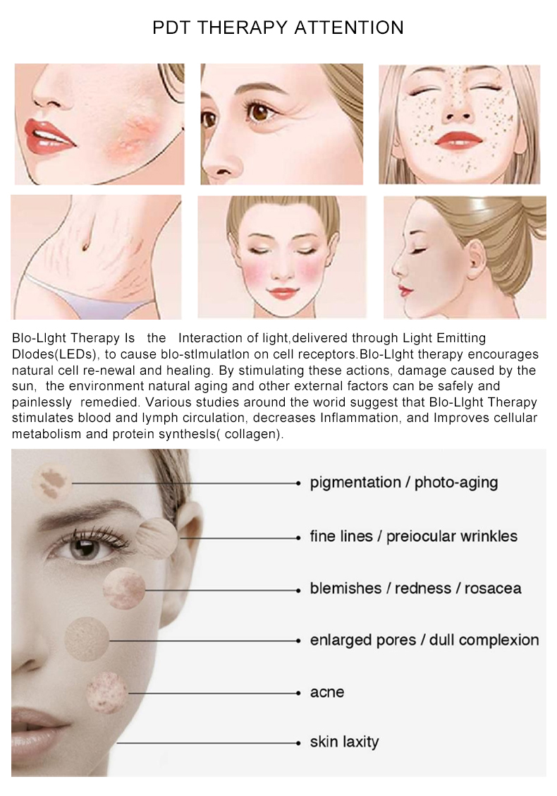 TSL 1127G pdt led 14